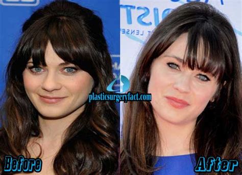 zooey deschanel plastic|zooey deschanel photo gallery.